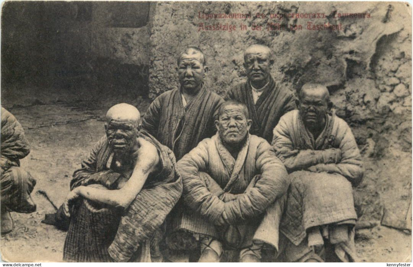 Aussätzige in der Nähe von Taschkent - Usbekistan