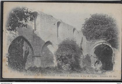 Compiègne - Ruines de Champlieu