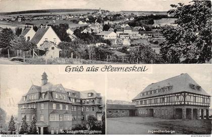 Hermeskeil Panorama Krankenhaus Jugendherberge gl1955? #152.103
