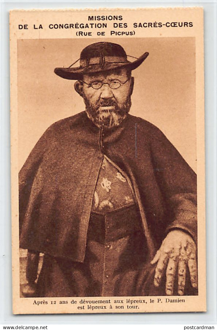 Hawaii - MOLOKAI - Leper Colony - After 12 years of dedication to lepers, Father Damien is also a leper - Publ. Missions