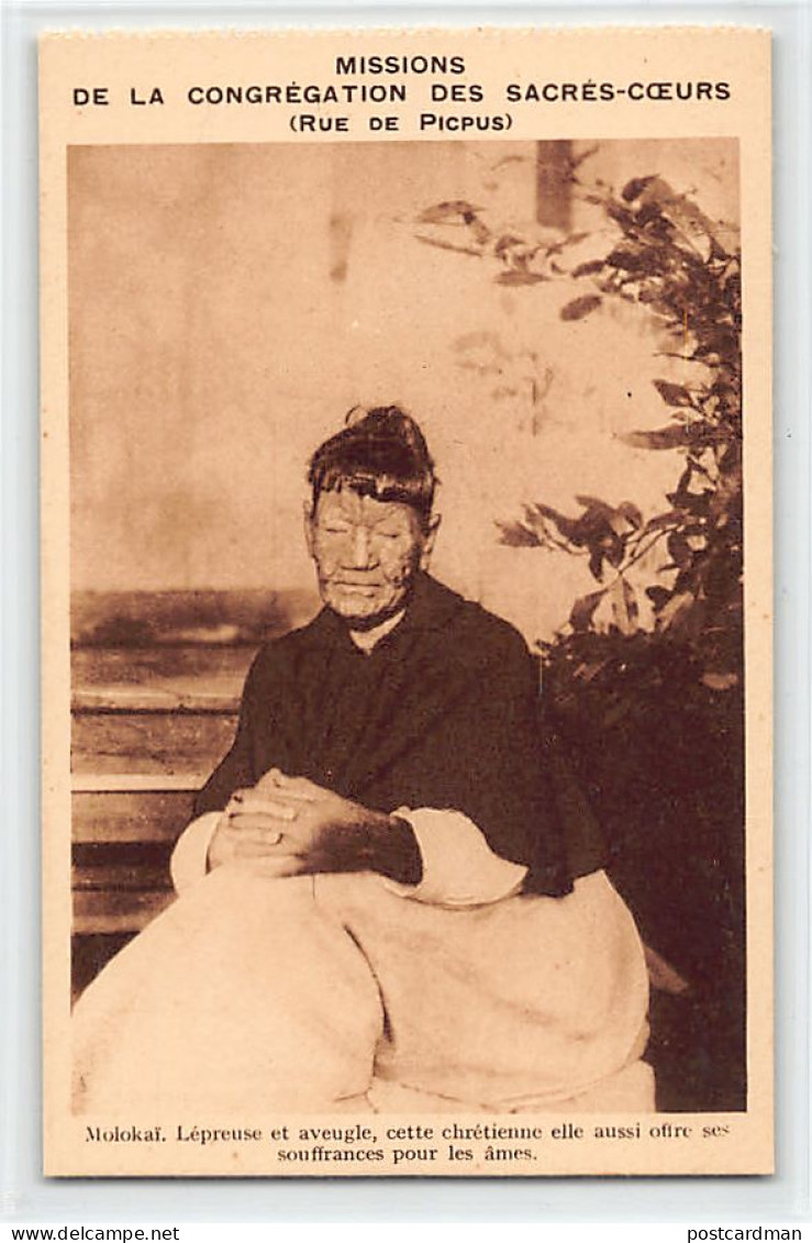 Hawaii - MOLOKAI - Leper colony - Leper and blind, this Christian woman also offers her suffering for the salvation of s