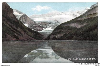 CAR-AEMP18-1002-CANADA - LAKE LOUISE - Rockies