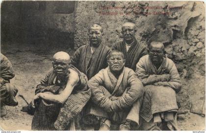 Aussätzige in der Nähe von Taschkent - Usbekistan