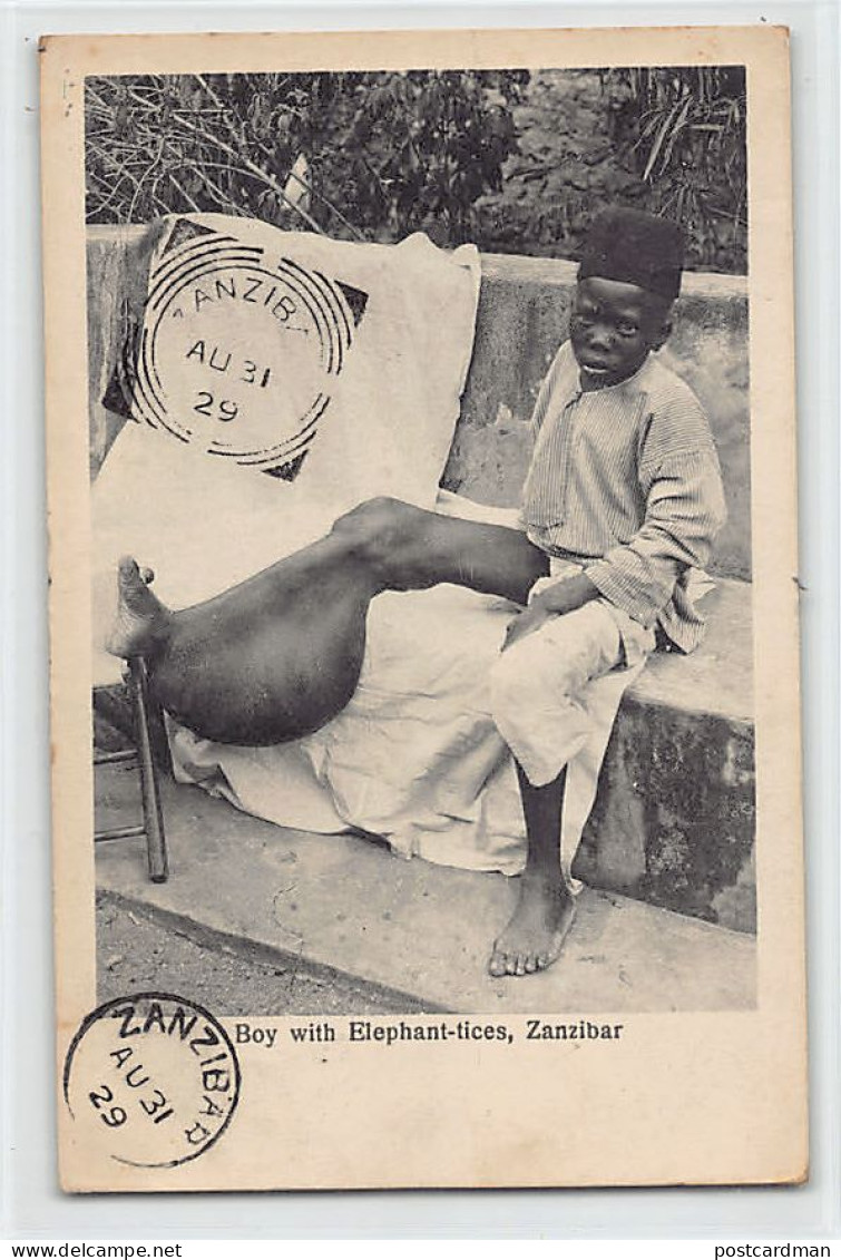 Tanzania - ZANZIBAR - Boy with Elephantiasis - Publ. A. C. Gomes & Son