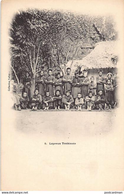 Vietnam - Lépreux tonkinois - Ed. Vallot 5